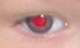 Red eye